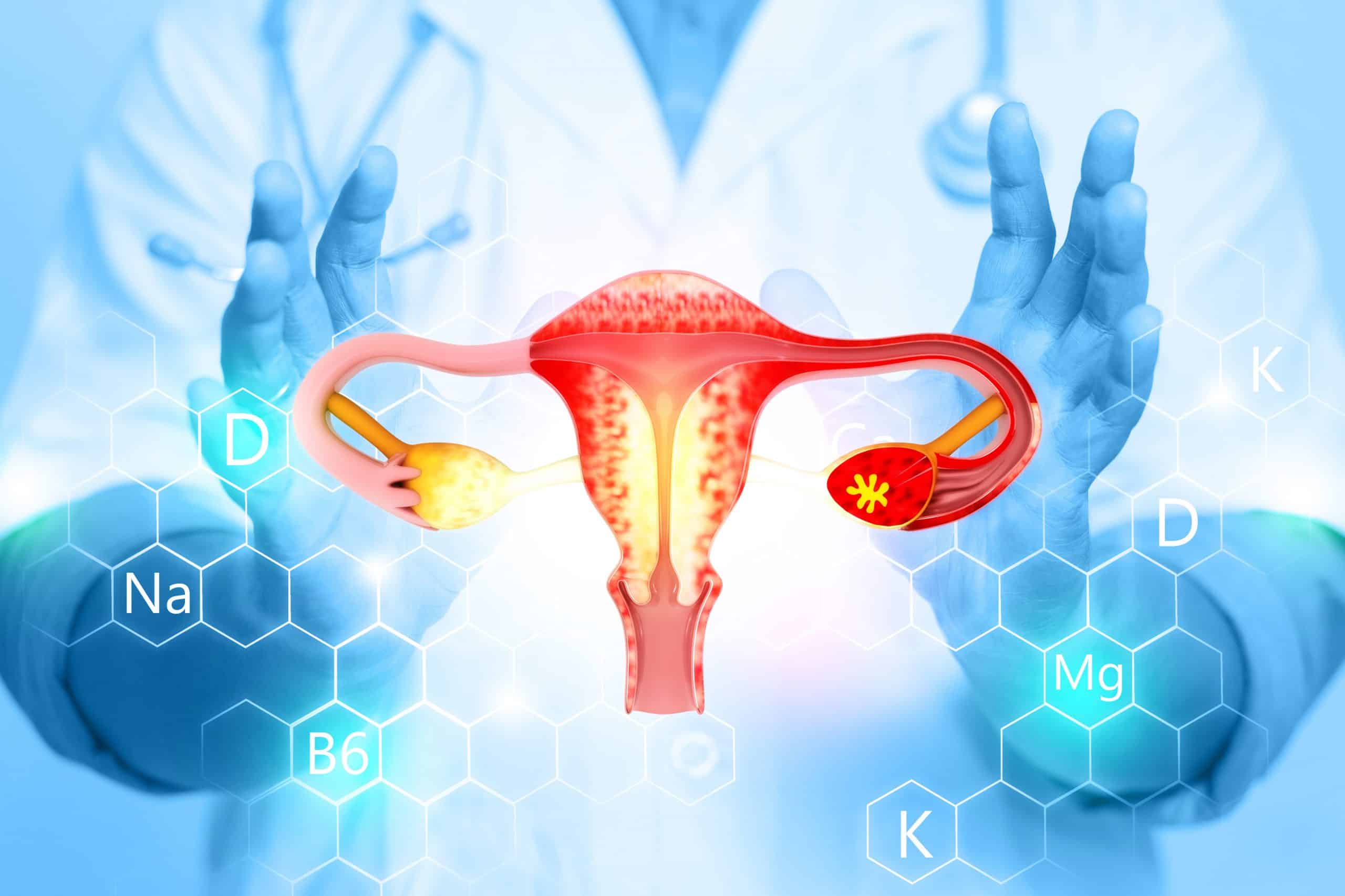 Cáncer de endometrio un nuevo test realizado en casa detecta casi el 100% de los casos