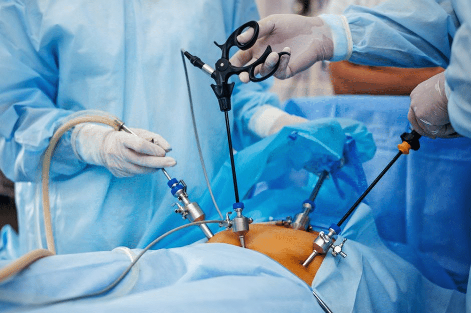La cirugía de escisión laparoscópica mejora la vida sexual de las mujeres con endometriosis infiltrante profunda