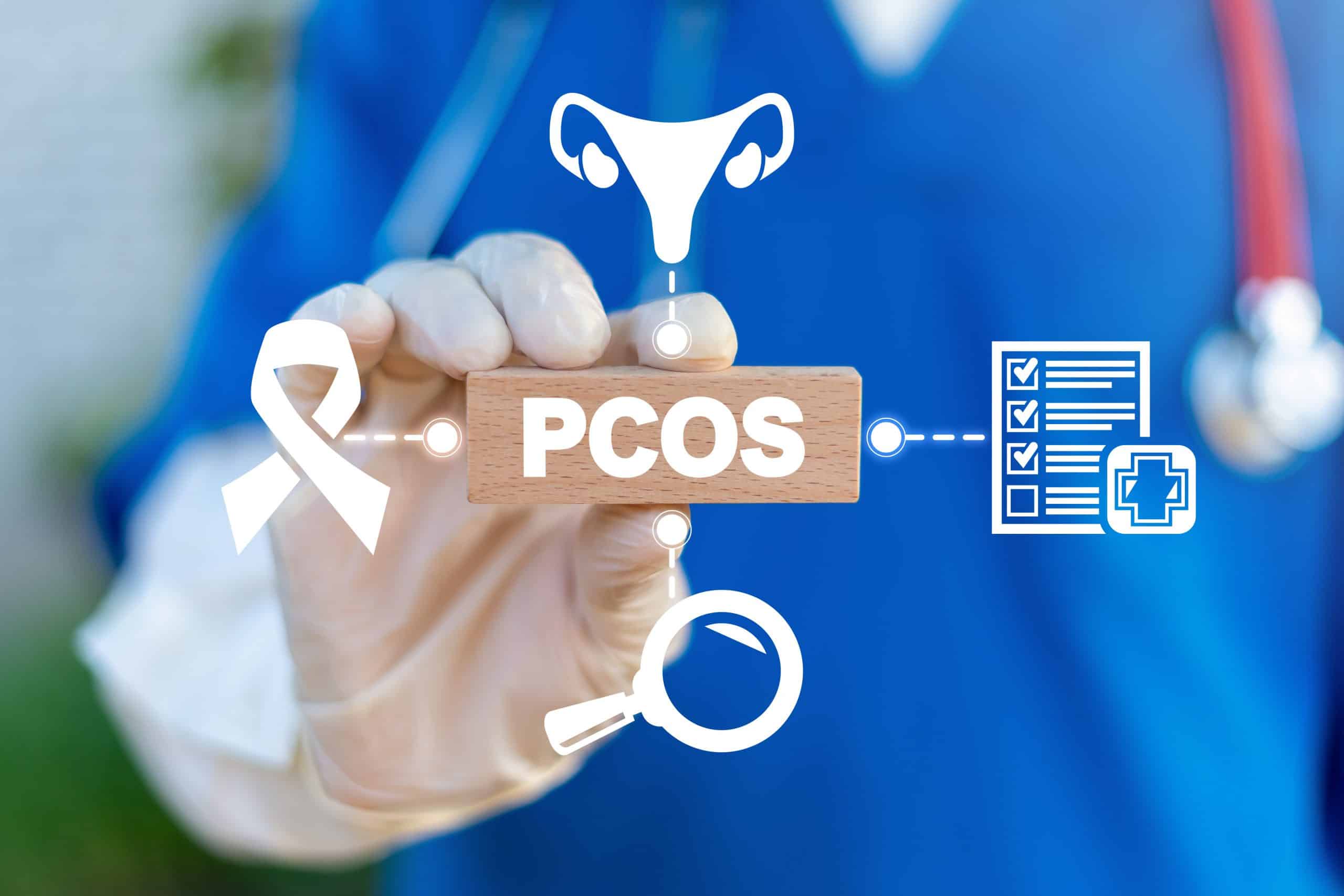 Síndrome de ovario poliquístico nuevo criterio que facilita la precisión en el tratamiento